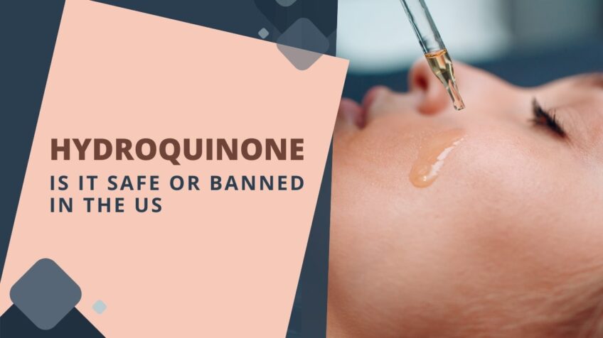 Hydroquinone Is It Safe