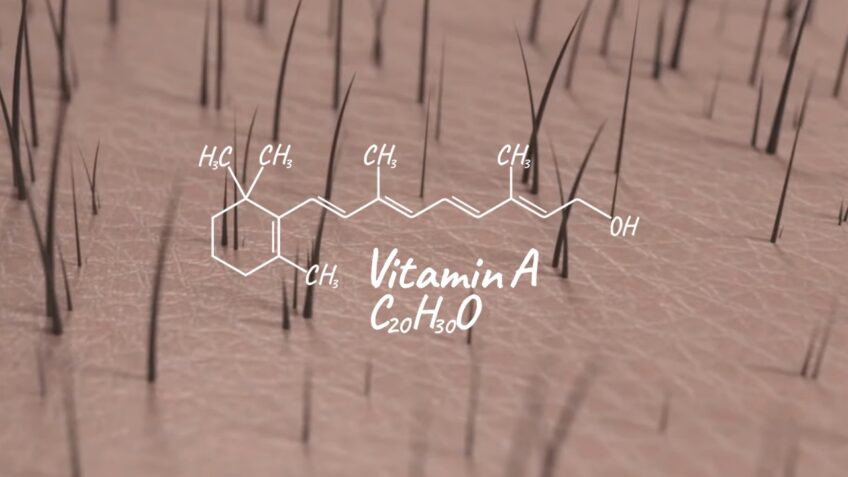 Increased Vitamin A Levels